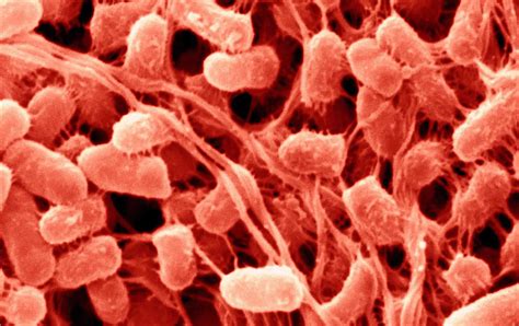 Serratia: Background, Pathophysiology, Epidemiology .